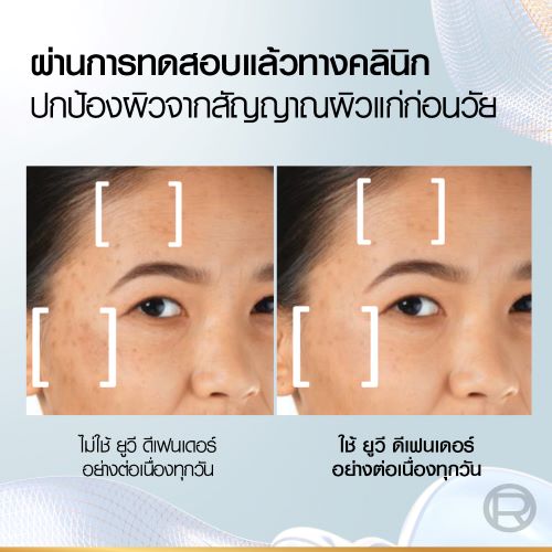 กันแดด